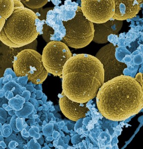 Staphylococcus aureau Magnification 20,000
