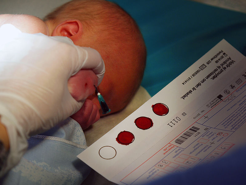 PKU-test av nyfödd bebis / Armigo (Wikimedia Commons)